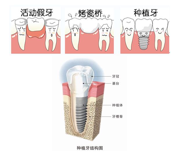 20140930033541419.png